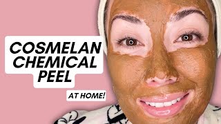 I Did a Cosmelan Chemical Peel at Home! Sharing the Process, Before and Afters, and Review