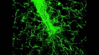 Capillary vessel tip in a 3D fibrin clot - mechanical probing filapodia - pt 3