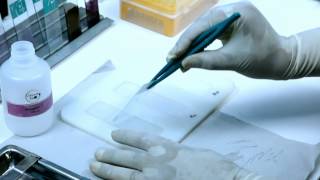DNA Fragmentation Test Procedure - Sperm360
