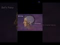 Bell's Palsy  (7th cranial nerve) | temporary facial #paralysis .