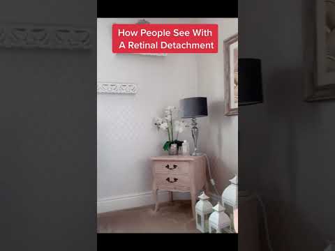 Retinal detachment Symptoms