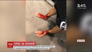 Невідомі морські істоти перетворили ноги австралійського підлітка на криваве місиво