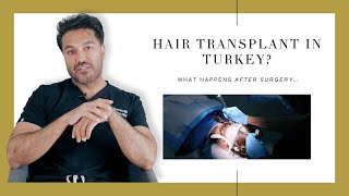 Canadian Hair Transplant Centre