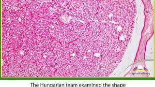 Action 11. Module 3. The Rosehip Neurone - A New Type of Brain Cell