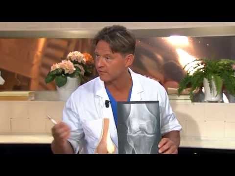 Doktor Mikael svarar på frågor om knän - Nyhetsmorgon (TV4)
