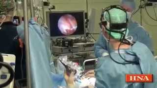 preview picture of video 'Das Herz durchs Schlüsselloch operieren - Mitralklappen-Operation'