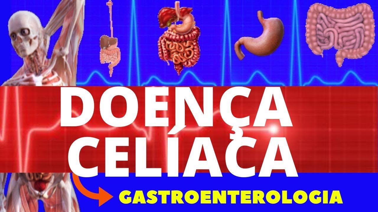DOENÇA CELÍACA - CAUSAS, SINTOMAS, DIAGNÓSTICO E TRATAMENTO - FISIOPATOLOGIA - GASTROENTEROLOGIA