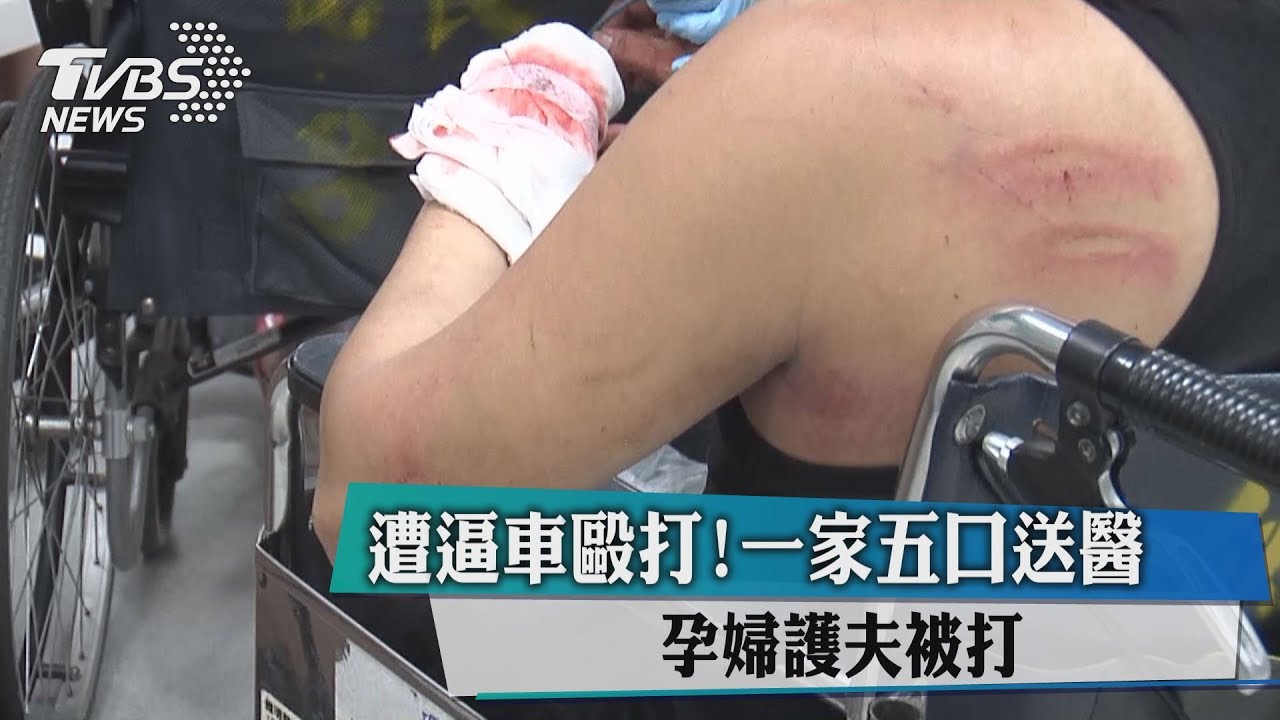 遭逼車毆打！孕婦護夫也受傷　一家五口送醫