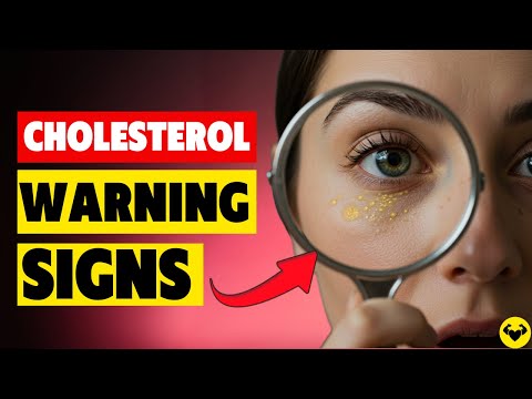 6 Warning Signs of Bad Cholesterol You Must Spot Before a Stroke