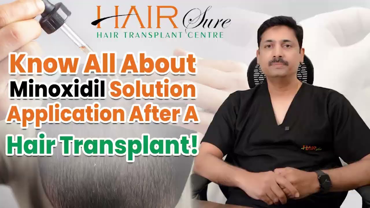 Minoxidil Application After Hair Transplant  | About minoxidil | Tips by Dr. Ravi Chander