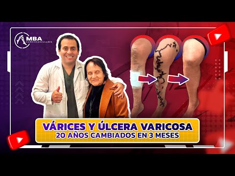 Manolo Briceño Alvarado-23