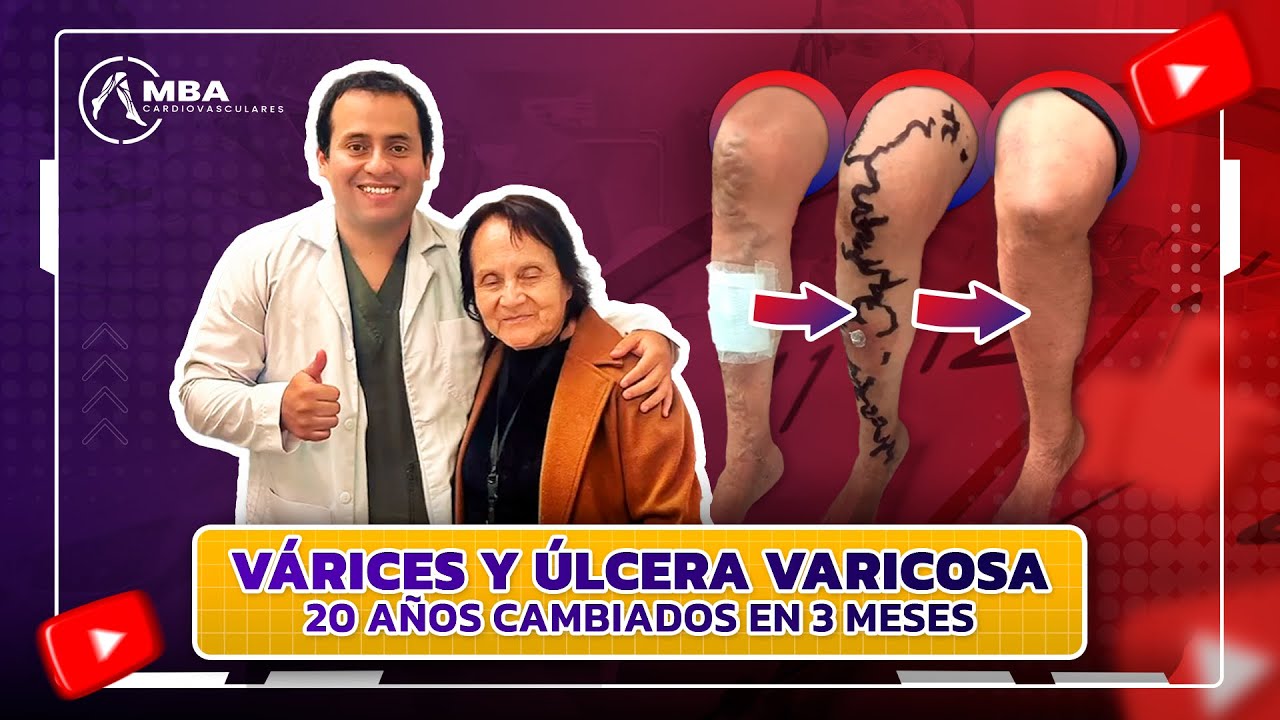 Manolo Briceño Alvarado-23