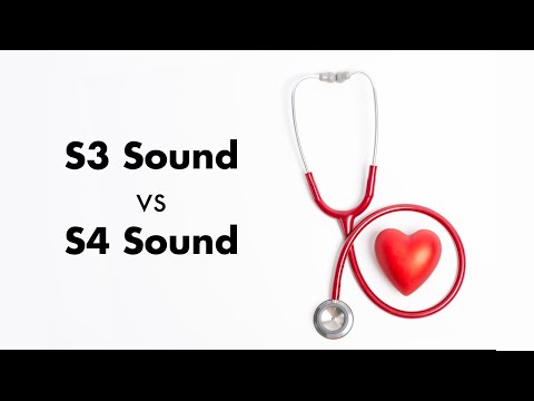 S3 vs S4 Heart Sound