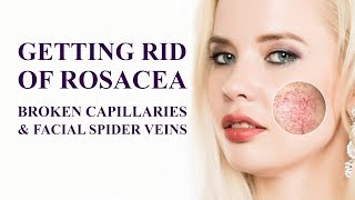 How to get rid of Rosacea, Broken Capillaries & Facial Spider Veins