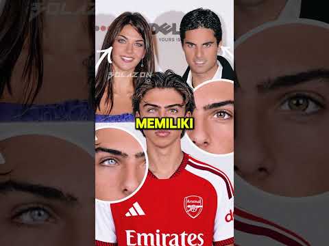 Kenapa Mata Anak Arteta Ini Berbeda?