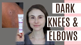 FADE DARK ELBOWS & KNEES| Q&A WITH DERMATOLOGIST DR DRAY