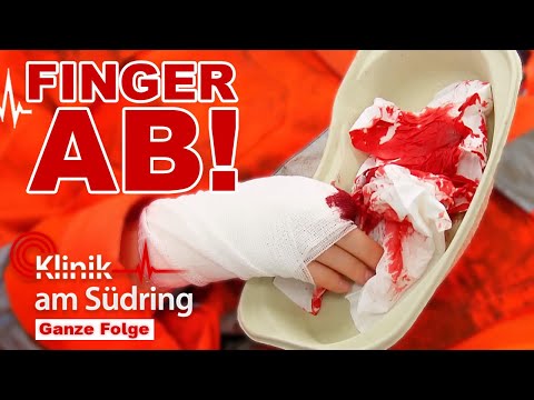 Not-Amputation? Wird die Patientin wirklich ihren Finger verlieren? | Klinik am Südring | SAT.1