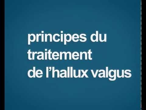 comment soigner l'hallux valgus