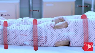 Product video: Kendall SCD Express Sleeves
