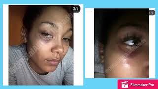 UPDATE ON CHRIS SAILS HITTING PARKER (MORE PROOF?)