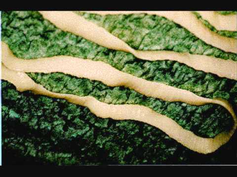 Biohelminth pinworm sau geohelminth