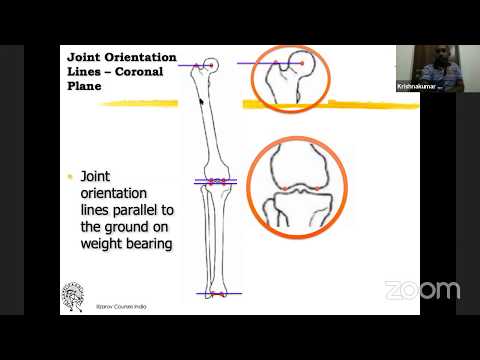 Principles of Coronal plane deformity correction