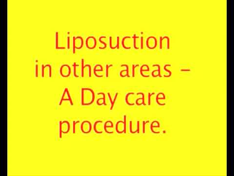 Liposuction