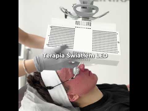 🤍 Laserowe odmładzanie, redukcja przebarwień ✨