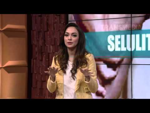 DR OZ INDONESIA 26 DESEMBER 2015 - Perbedaan Stretchmark Dan Selulit