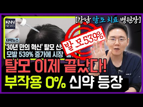탈모 신약 539% 효과? 이거 믿고 '존버'하면 100% 망하는 이유 (출시일, 가격, 부작용 총정리)