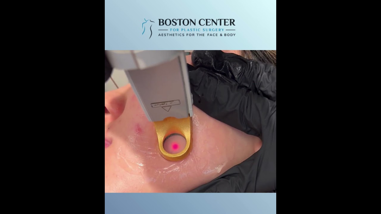 Boston Center for Plastic Surgery