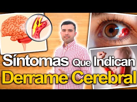 Watch Out for These Symptoms - Stroke Symptoms and How to Prevent It Naturally