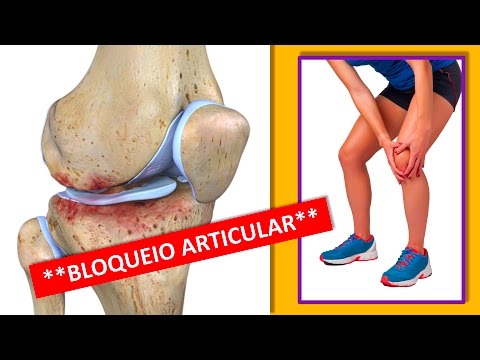 Numirea tratamentului pentru artroza genunchiului