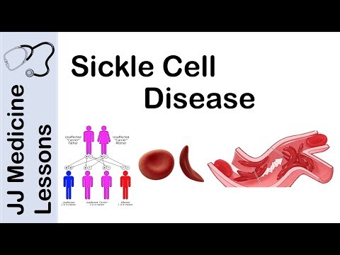 Sickle Cell Disease | Pathophysiology, Symptoms and Treatment