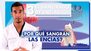 ¿ENCÍAS SANGRANTES Causas y tratamiento del sangrado de encías  / #Shorts
