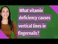 What vitamin deficiency causes vertical lines in fingernails?