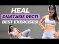 Best Exercises To HEAL DIASTASIS RECTI 13 Min Workout To Close Ab Separation Lose Your Mom Pooch