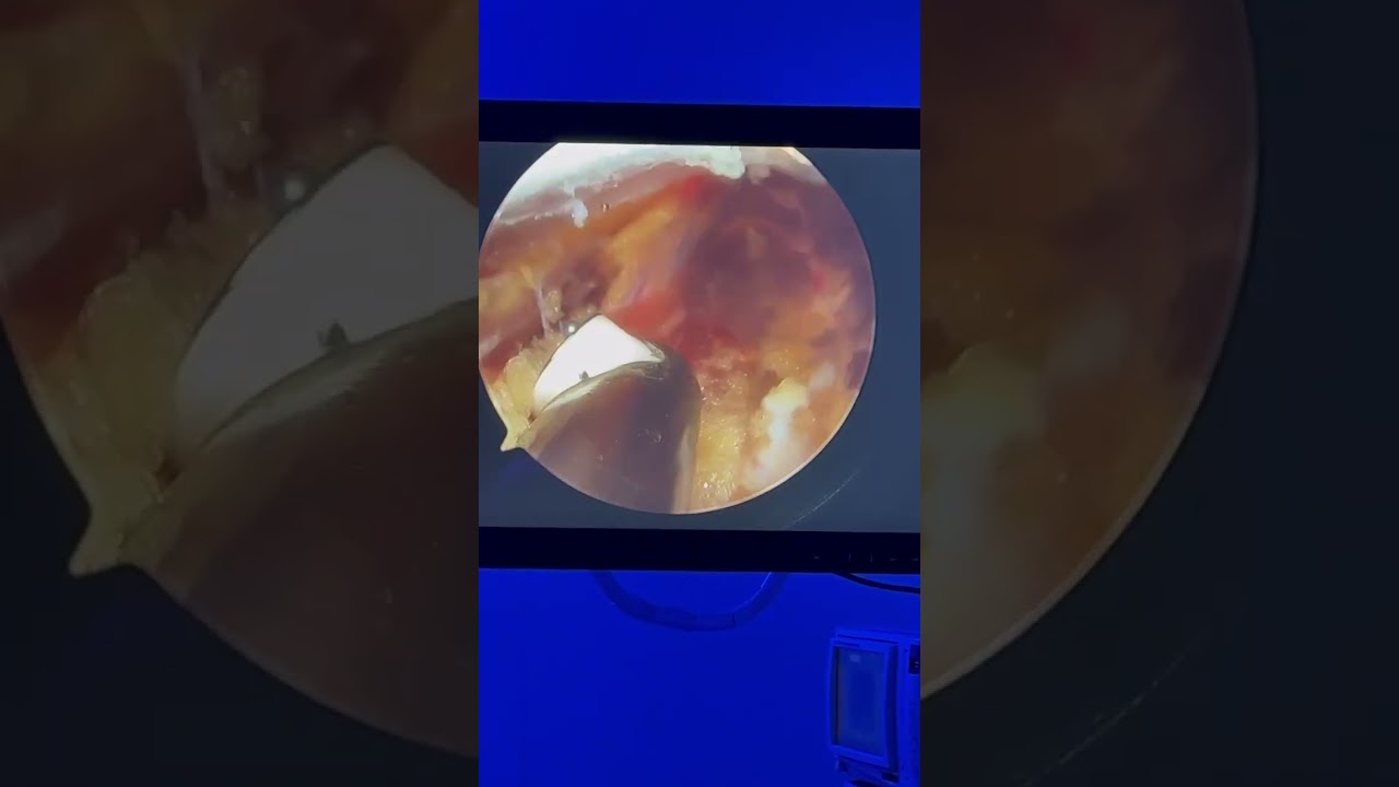 Luis Alfredo Miranda Ocaña-18