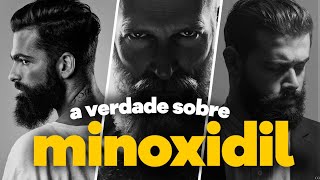 a VERDADE sobre usar MINOXIDIL na BARBA | glow up masculino 2024
