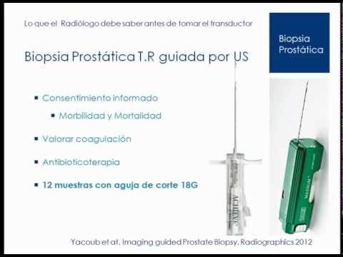 Dolore nella prostatite rimedio popolare Curare per il tè prostatite salice