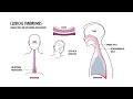 Deep Neck Infection Causes, specific syndromes and symptoms, Complications & Treatment