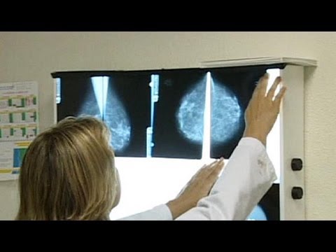 Reino Unido vai disponibilizar tratamento preventivo para cancro da mama