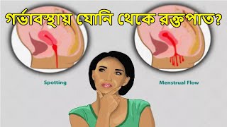 গর্ভাবস্থায় যোনি থেকে রক্তপাত হওয়ার কারন কি Implantation Bleeding During Pregnancy in Bangla