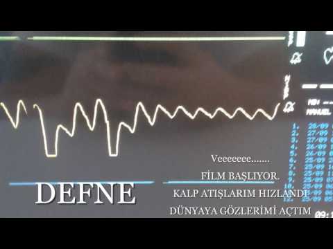 Hosgeldin Defne Bebek