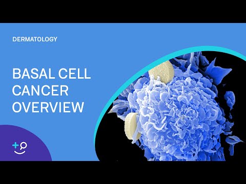 image-How common is basal cell carcinoma in the US?