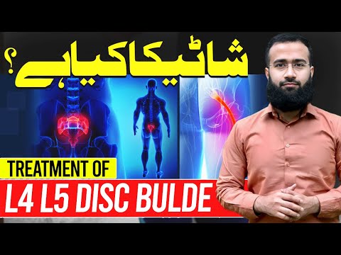 What is Sciatica? Treatment of L4L5 Disc Bulde or Herniation