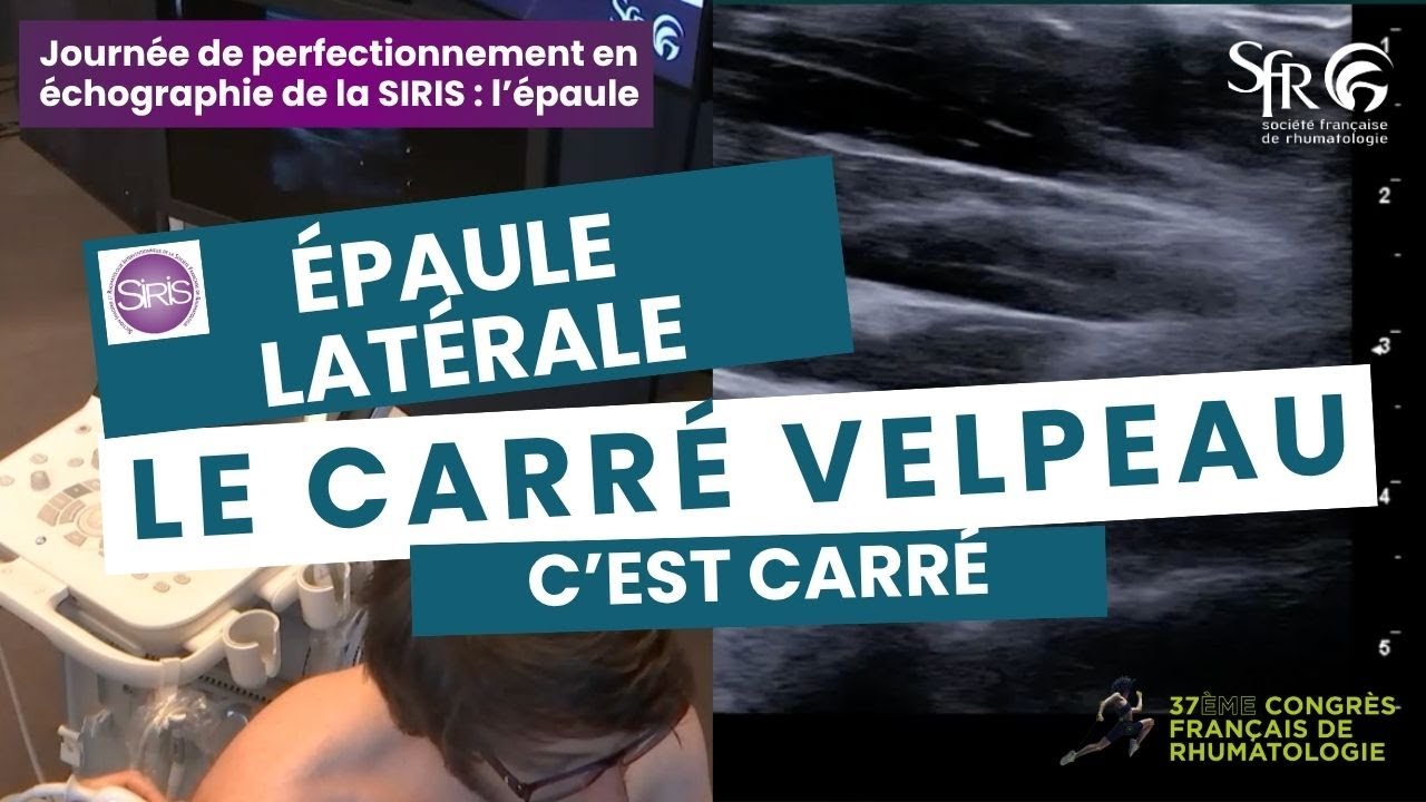 Journée de perfectionnement en échographie de la SIRIS