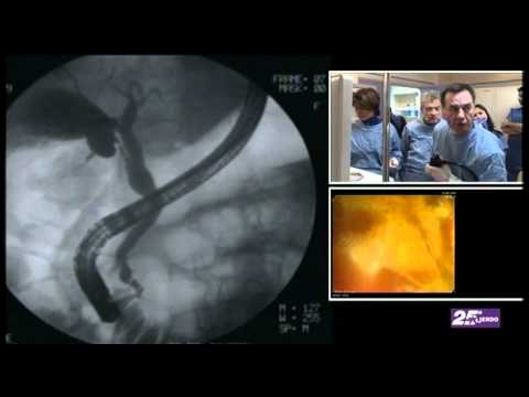 comment guerir une pancreatite aigue