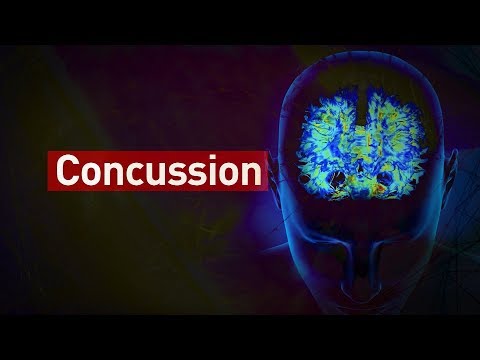 How do concussions affect the brain?