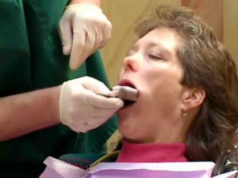 What is TMD - Encino TMJ Migraine